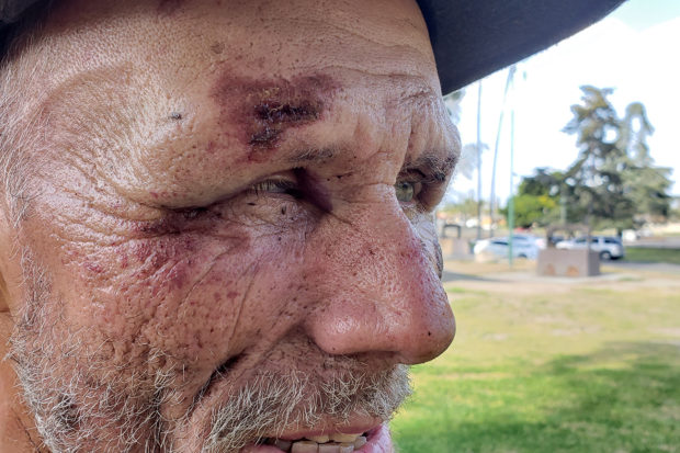 Fresno Police Officers Assaulted Homeless Man