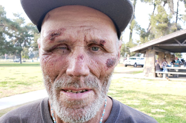 Homeless Man Brutalized by Fresno Police Has a Victory in Court
